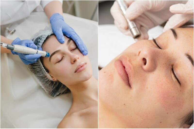 Pro Facial + алмазная микродермабразия в Риге