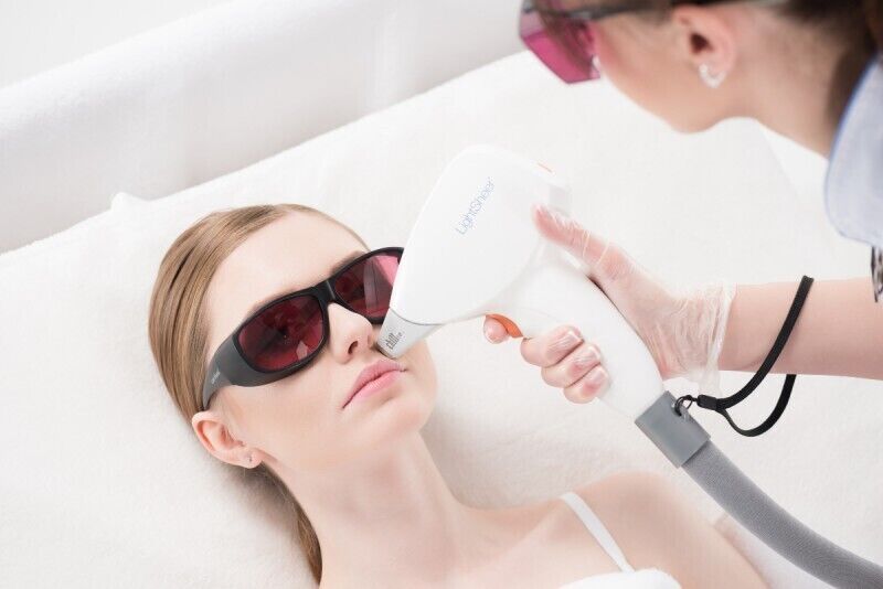 Процедура лазерной эпиляции зоны у верхней губы для женщин
