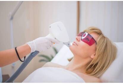 Процедура лазерной эпиляции на подбородке для женщин